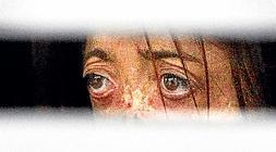 Fide Mirón perdió los labios, la nariz , las manos.../ Txema Rodríguez/