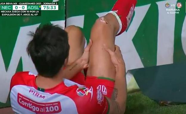 Unai Bilbao manda mensaje tras su impresionante lesión, asegura que se encuentra bien