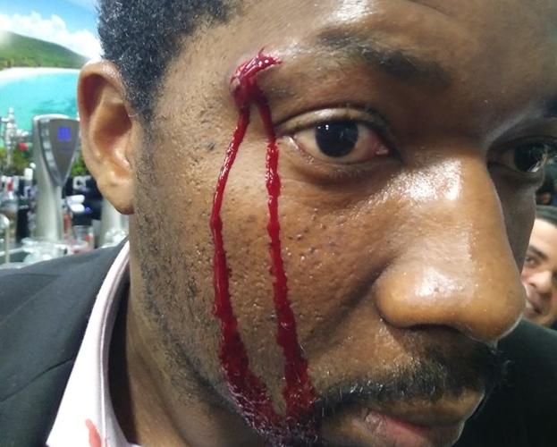 Un actor negro es víctima de una agresión racista en Móstoles: «Puedo matarlo y no me pasaría nada porque soy blanca»