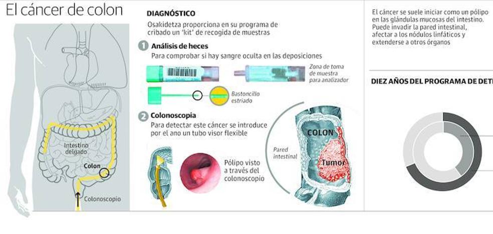Los programas de prevención reducirán un 26% las muertes por cáncer colorrectal en 30 años