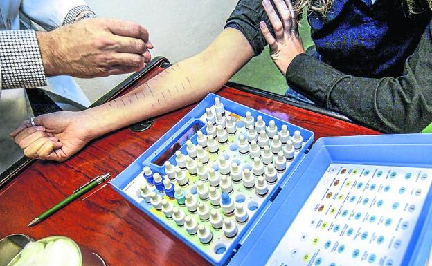 Las alergias alimentarias condicionan la vida de más de 7.000 alaveses