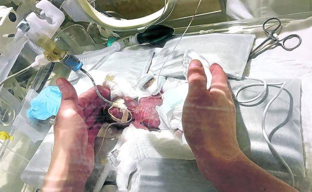 El milagro de vivir pesando 268 gramos