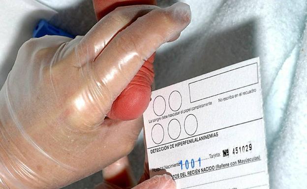 La prueba del talón en los bebés se amplía para detectar la falta de una vitamina