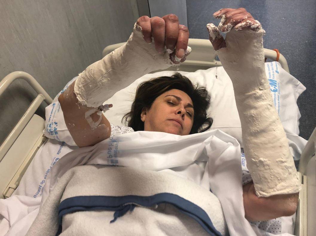 Rosa García, consejera delegada de Alibérico: «Desconectada porque me he roto las dos muñecas»