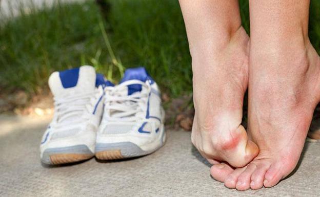 Deporte sin control y sobrepeso favorecen el dolor en los pies