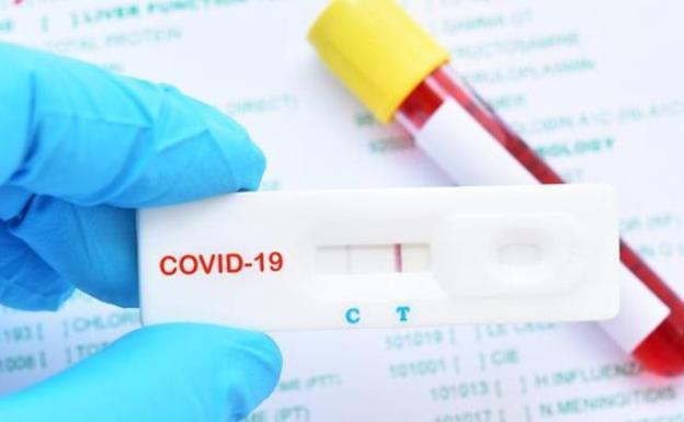 Un test más rápido que la PCR y sin laboratorio