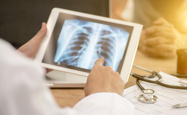 «El covid provocará un aumento de las muertes por tumores»