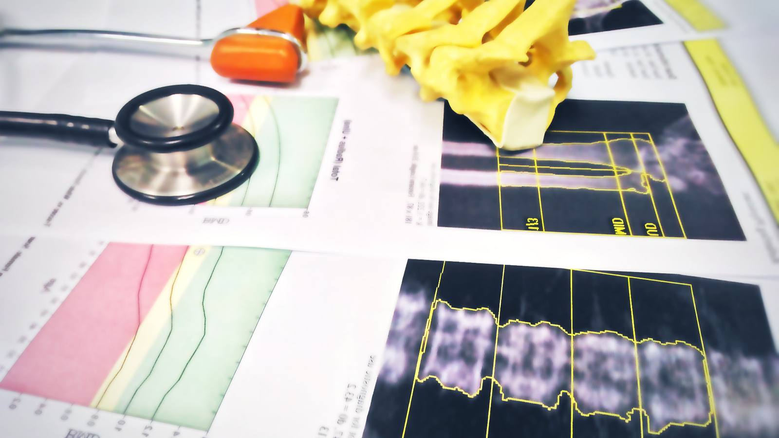 La osteoporosis, detrás del 80% de las fracturas en mujeres menopaúsicas