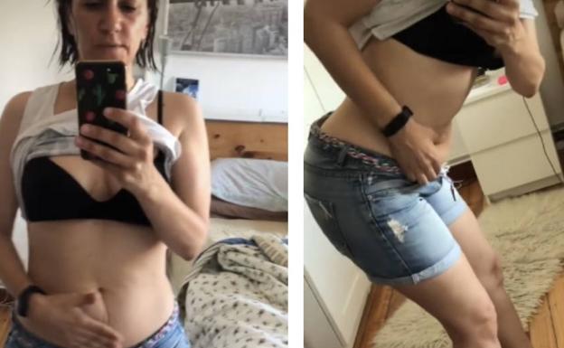 El alegato viral de una dietista vasca: «Este es mi cuerpo y no lo voy a esconder»