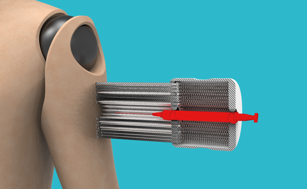 Este invento español quiere acabar con el miedo a la vacunación