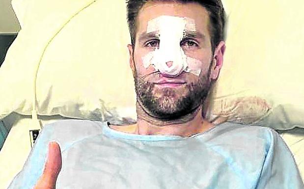 Withey será baja ante el Barça por una fractura de nariz