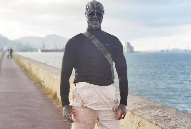 El joven francés que quiere parecer un alien se opera en Bizkaia