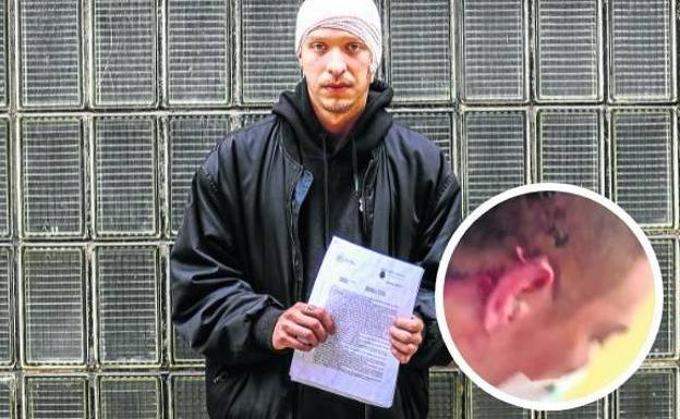 «Dijeron maricón de mierda, me giré y me dieron un puñetazo a cada lado de la cabeza»