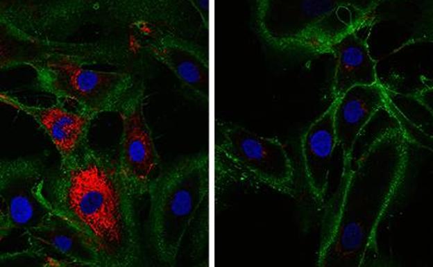 Científicos de Cambridge rejuvenecen la piel de una mujer