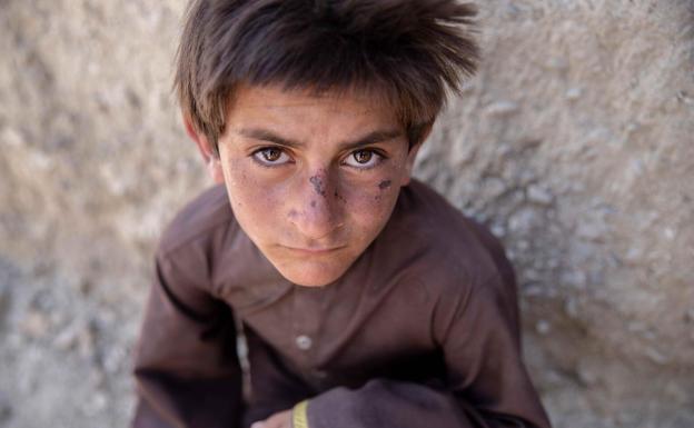 Afganistango haurrek behar gaituzte