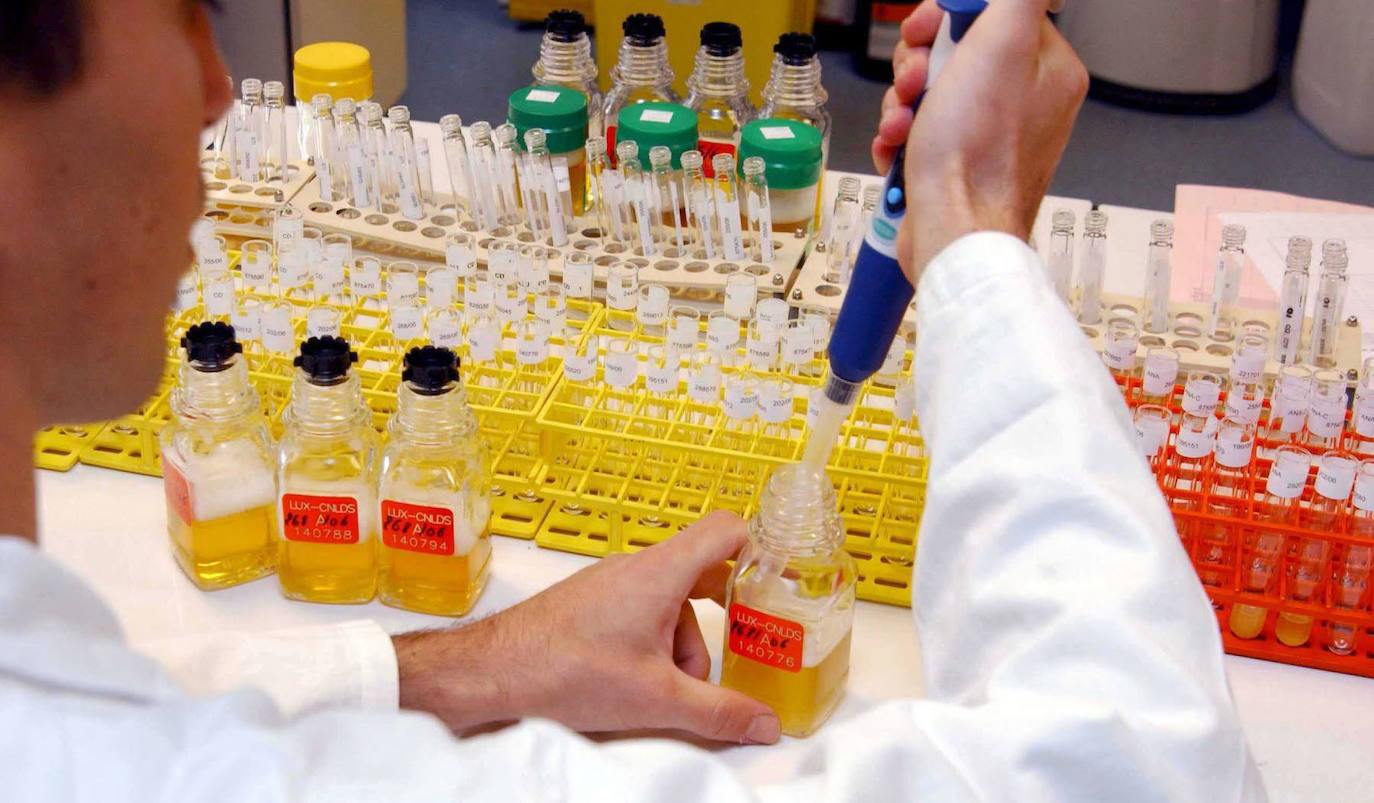 Penes de silicona por 130 euros para engañar en los controles antidopaje