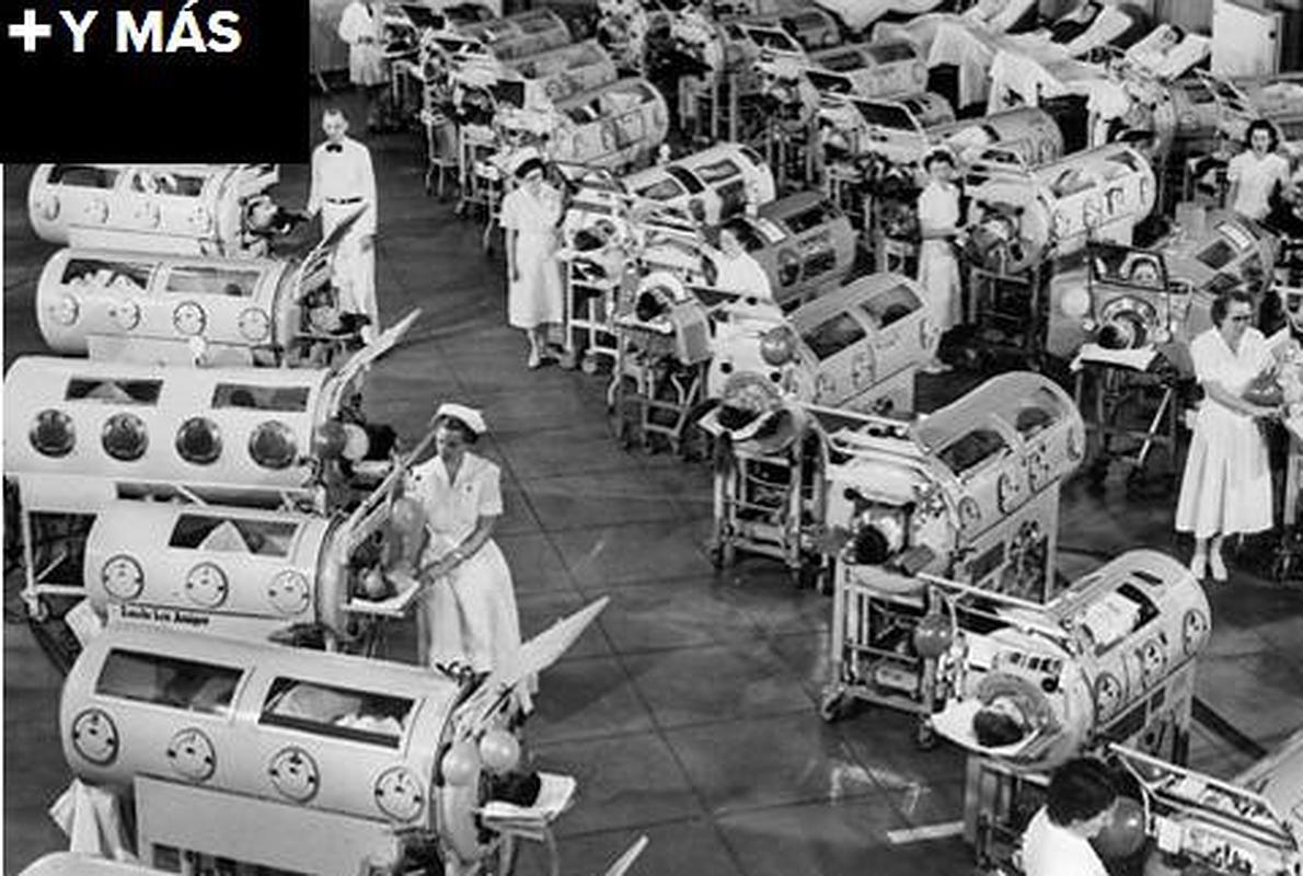 El fantasma de la polio