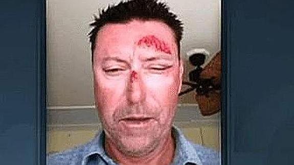 Robert Allenby, secuestrado y apaleado en un bar de Hawaii
