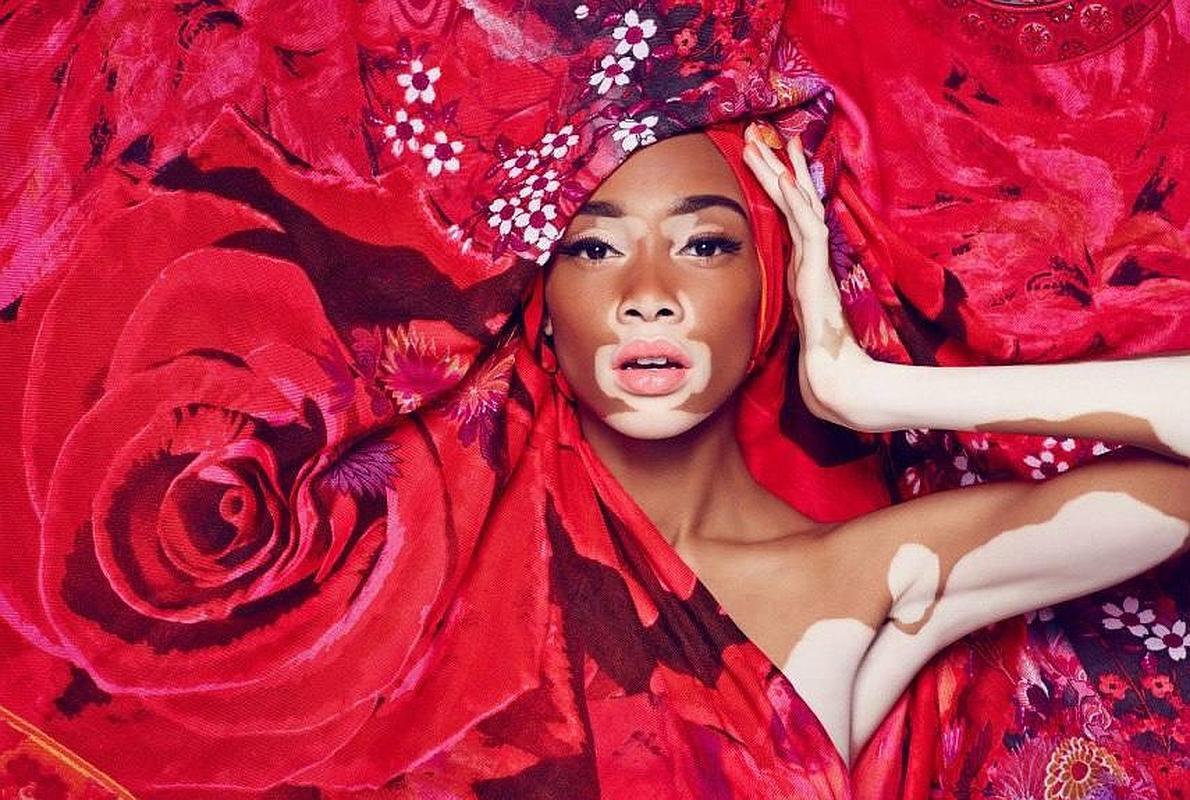 Las atípicas están muy de moda