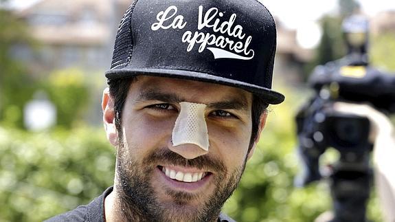 Cesc Fábregas tiene nariz nueva