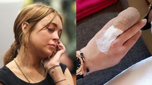 Lindsay Lohan pierde por accidente parte de un dedo