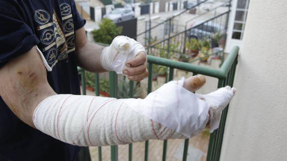 «¡Matadlo o me mata él a mí!», el escalofriante relato de un dueño atacado por su propio perro